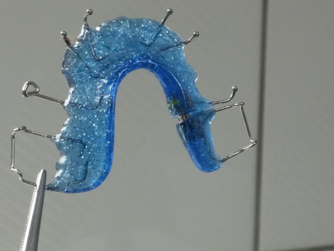 orthodontist in Lahore braces and teeth straightening at Odonto